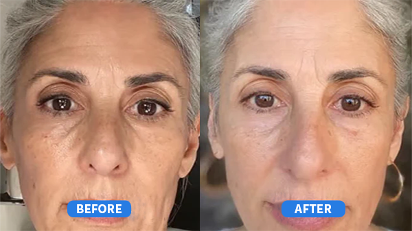 Refirm's Retinal Cream