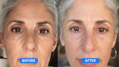 Refirm's Retinal Cream