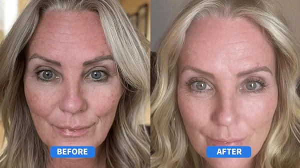 Refirm's Retinal Cream