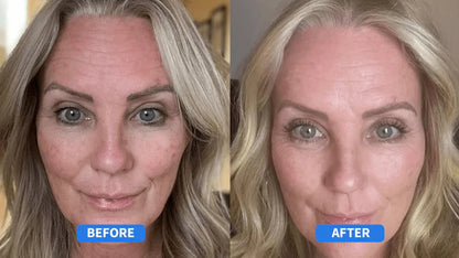 Refirm's Retinal Cream