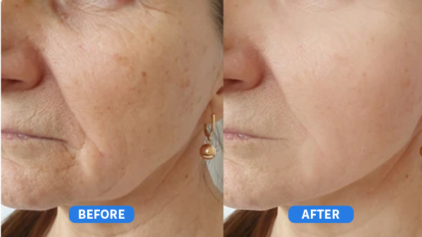 Refirm's Retinal Cream